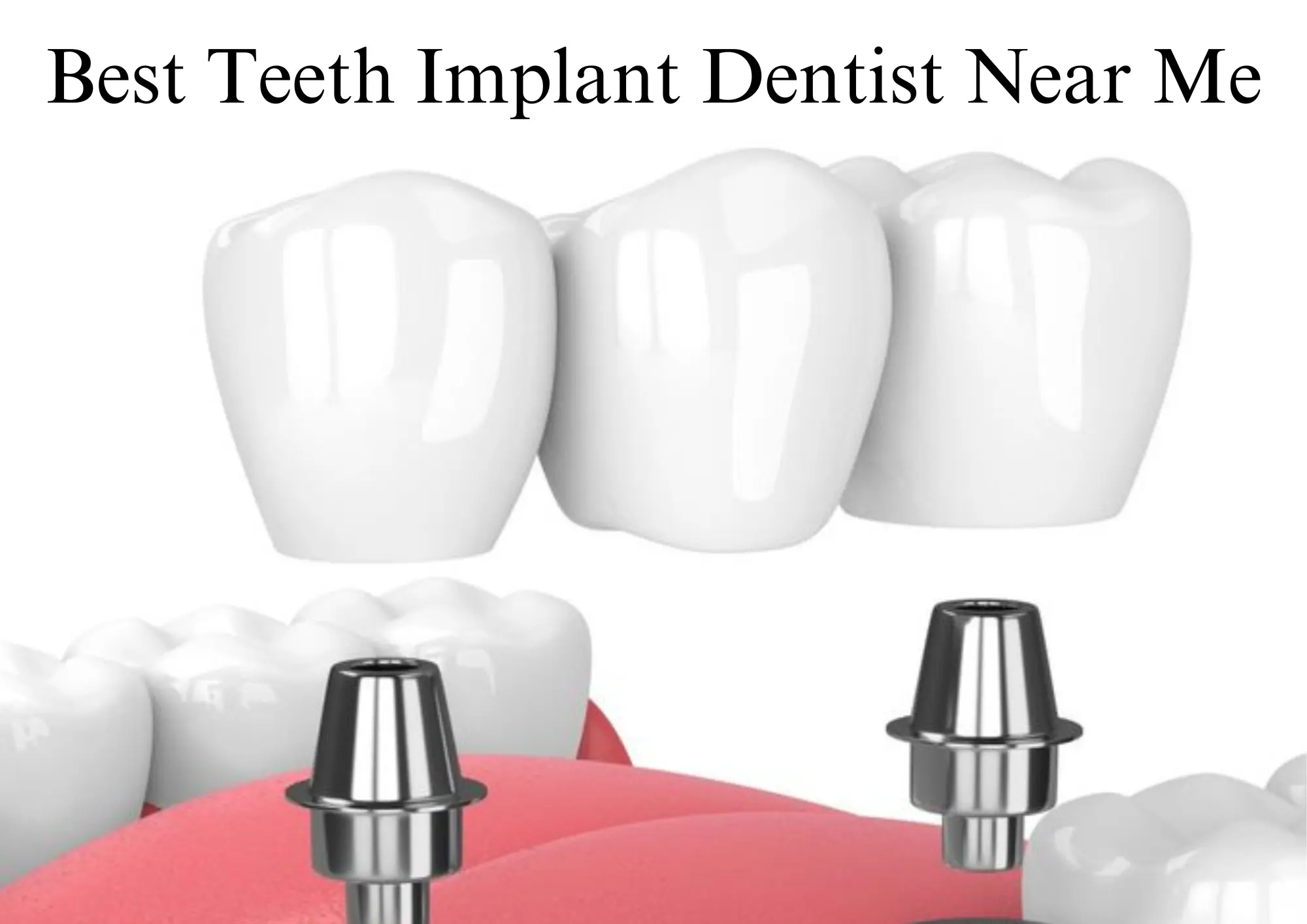 15 Tips For cosmetic smile redesign Success